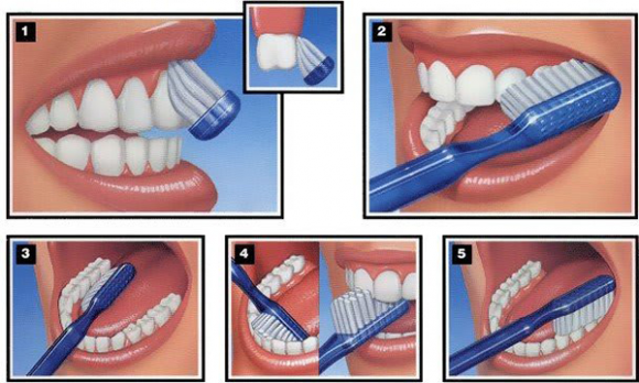 Higiene Oral – Goñi Odontologos